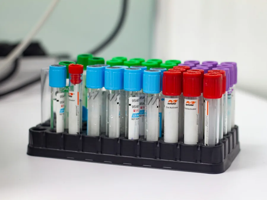 A rack of labelled pathology collection tubes